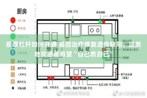 股票杠杆如何开通 基因治疗修复遗传缺陷，这类地贫患者有望“自己救自己”